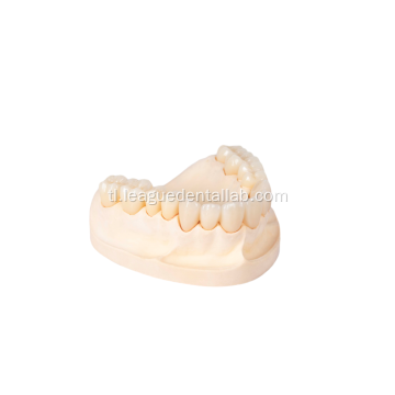 3d multilayer zirconia para sa mga restorasyon ng ngipin